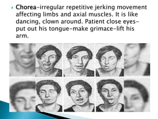  Chorea-irregular repetitive jerking movement
affecting limbs and axial muscles. It is like
dancing, clown around. Patient close eyes-
put out his tongue-make grimace-lift his
arm.
 