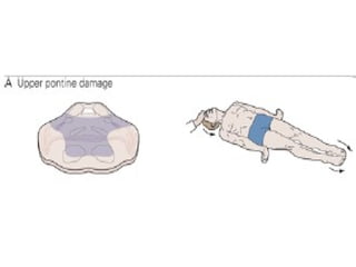 Pyramidal Medical Extrapyramidal system by Dr. Sunita M. Tiwale, Prof in Physiology,D. Y ...