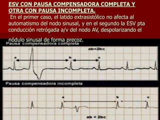 ESV CON PAUSA COMPENSADORA COMPLETA Y
OTRA CON PAUSA INCOMPLETA.
En el primer caso, el latido extrasistólico no afecta al
automatismo del nodo sinusal, y en el segundo la ESV pta
conducción retrógada a/v del nodo AV, despolarizando el
nódulo sinusal de forma precoz.
 