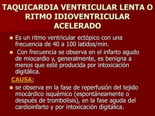 TAQUICARDIA VENTRICULAR LENTA O
RITMO IDIOVENTRICULAR
ACELERADO
 Es un ritmo ventricular ectópico con una
frecuencia de 40 a 100 latidos/min.
 Con frecuencia se observa en el infarto agudo
de miocardio y, generalmente, es benigna a
menos que esté producida por intoxicación
digitálica.
CAUSA:
 se observa en la fase de reperfusión del tejido
miocárdico isquémico (espontáneamente o
después de trombolisis), en la fase aguda del
cardioinfarto y por intoxicación digitálica.
 