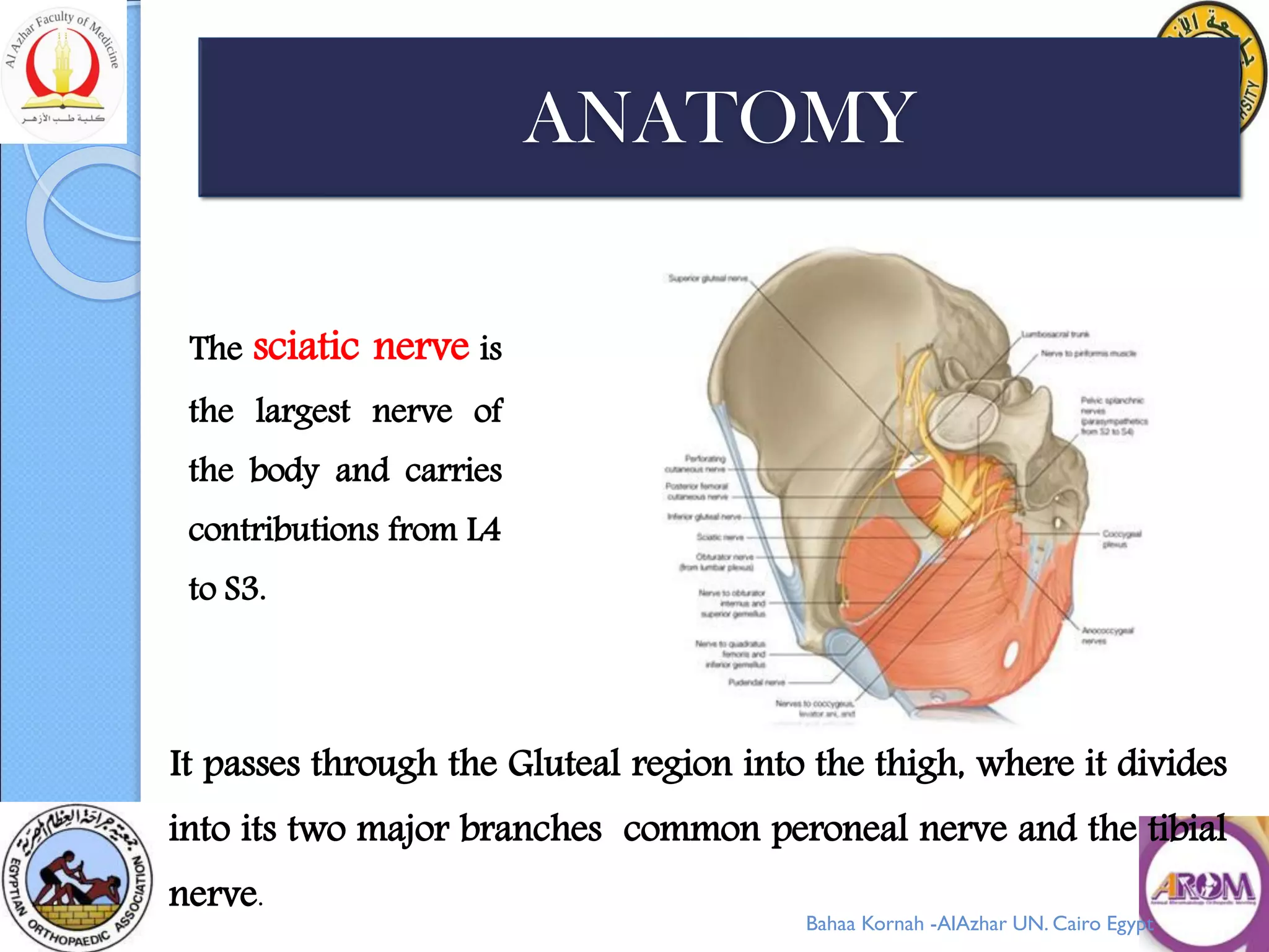 Extra Spinal Causes Of Sciatica And A Causes Algorithm Ppt