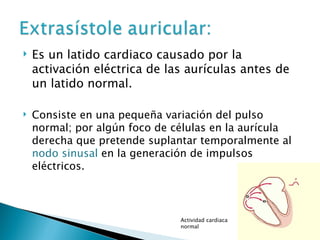 ExtrasíStoles Auriculares | PPT