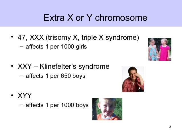 Extra X Or Y Chromosome Extra X Or Y Chromosome