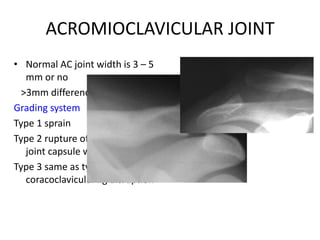 Extremity trauma | PPTX