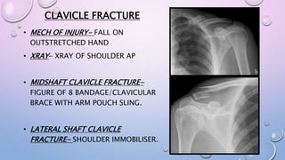 CLAVICLE FRACTURE
• MECH OF INJURY- FALL ON
OUTSTRETCHED HAND
• XRAY- XRAY OF SHOULDER AP
• MIDSHAFT CLAVICLE FRACTURE-
FIGURE OF 8 BANDAGE/CLAVICULAR
BRACE WITH ARM POUCH SLING.
• LATERAL SHAFT CLAVICLE
FRACTURE- SHOULDER IMMOBILISER.
 