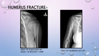 HUMERUS FRACTURE-
XRAY OF SHOULDER AP/
AXIAL/ SCAPULAR Y VIEW
XRAY OF HUMERUS AP/LAT
 