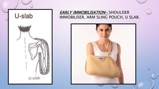EARLY IMMOBILISATION- SHOULDER
IMMOBILISER, ARM SLING POUCH, U SLAB.
 