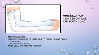 IMMOBILIZATION-
ABOVE ELBOW SLAB,
ARM POUCH SLING
ABOVE ELBOW SLAB-
EXTEND FROM MIDDLE OF UPPER ARM TO DISTAL PALMAR CREASE
ELBOW AT 90*
FOREARM IN MID PRONE
WRIST USUALY IN NEUTRAL POSITION
 
