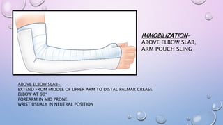 IMMOBILIZATION-
ABOVE ELBOW SLAB,
ARM POUCH SLING
ABOVE ELBOW SLAB-
EXTEND FROM MIDDLE OF UPPER ARM TO DISTAL PALMAR CREASE
ELBOW AT 90*
FOREARM IN MID PRONE
WRIST USUALY IN NEUTRAL POSITION
 