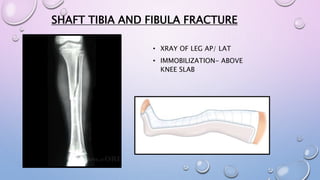 SHAFT TIBIA AND FIBULA FRACTURE
• XRAY OF LEG AP/ LAT
• IMMOBILIZATION- ABOVE
KNEE SLAB
 