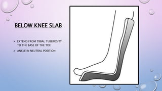 BELOW KNEE SLAB
 EXTEND FROM TIBIAL TUBEROSITY
TO THE BASE OF THE TOE
 ANKLE IN NEUTRAL POSITION
 