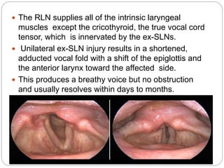  The RLN supplies all of the intrinsic laryngeal
muscles except the cricothyroid, the true vocal cord
tensor, which is innervated by the ex-SLNs.
 Unilateral ex-SLN injury results in a shortened,
adducted vocal fold with a shift of the epiglottis and
the anterior larynx toward the affected side.
 This produces a breathy voice but no obstruction
and usually resolves within days to months.

 