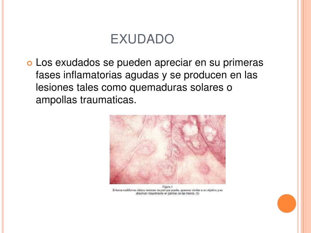 Exudado
