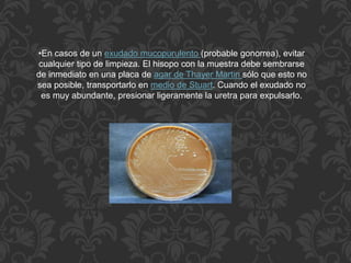 •En casos de un exudado mucopurulento (probable gonorrea), evitar 
cualquier tipo de limpieza. El hisopo con la muestra debe sembrarse 
de inmediato en una placa de agar de Thayer Martin sólo que esto no 
sea posible, transportarlo en medio de Stuart. Cuando el exudado no 
es muy abundante, presionar ligeramente la uretra para expulsarlo. 
 