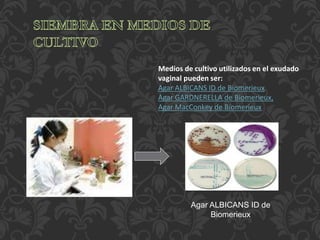 Medios de cultivo utilizados en el exudado 
vaginal pueden ser: 
Agar ALBICANS ID de Biomerieux 
Agar GARDNERELLA de Biomerieux, 
Agar MacConkey de Biomerieux 
Agar ALBICANS ID de 
Biomerieux 
 