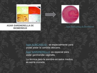 AGAR GARDNERELLA DE 
BIOMERIEUX 
Agar MacConkey de Biomerieux 
Agar ALBICANS ID : es especialmente para 
poder aislar la candida albicans. 
Agar GARDNERELLA: es especial para 
aislar gardnerella vaginalis. 
La técnica para la siembra en estos medios 
es estría cruzada. 
 