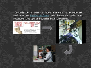•Después de la toma de muestra a esta se le debe ser 
realizada una tinción de Gram. esta tinción se realiza para 
reconocen que tipo de bacterias están presentes. 
 
