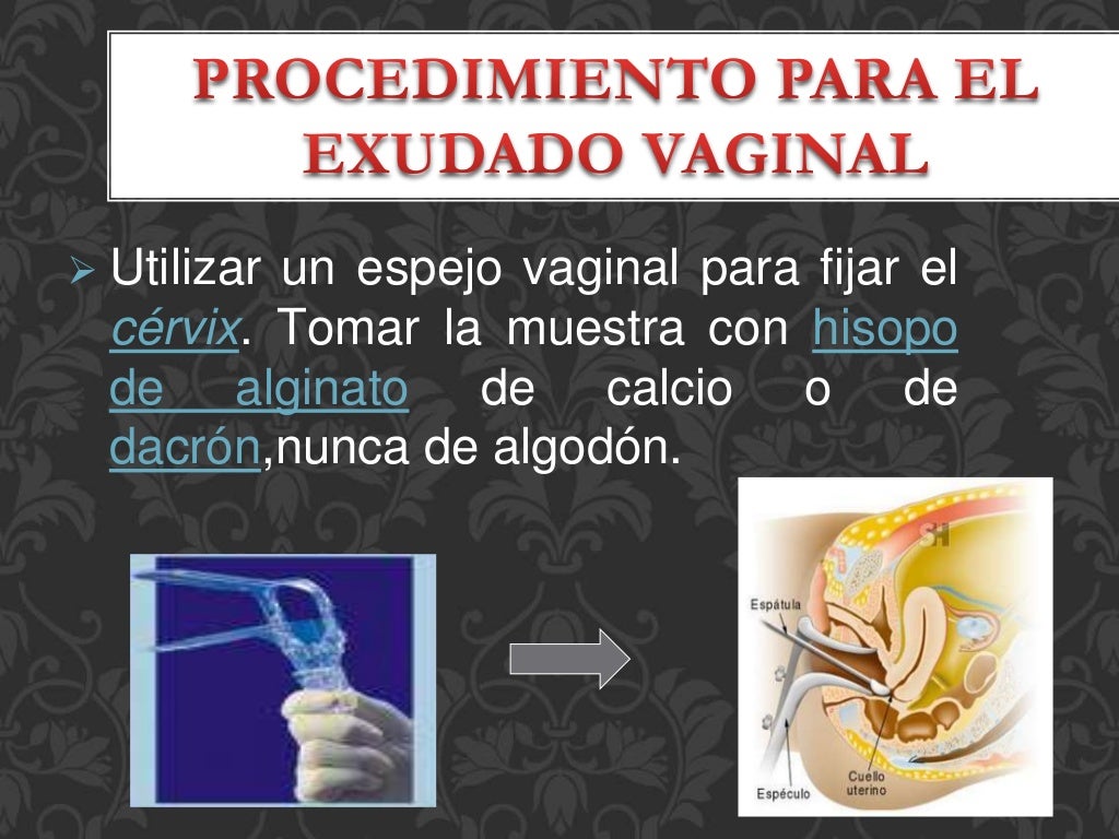 Exudado faringeo y vaginal