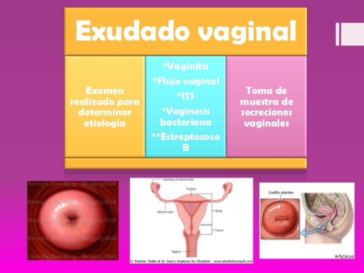 Exudado vaginal