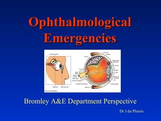 Ophthalmological Emergencies Bromley A&E Department Perspective  Dr J du Plessis 