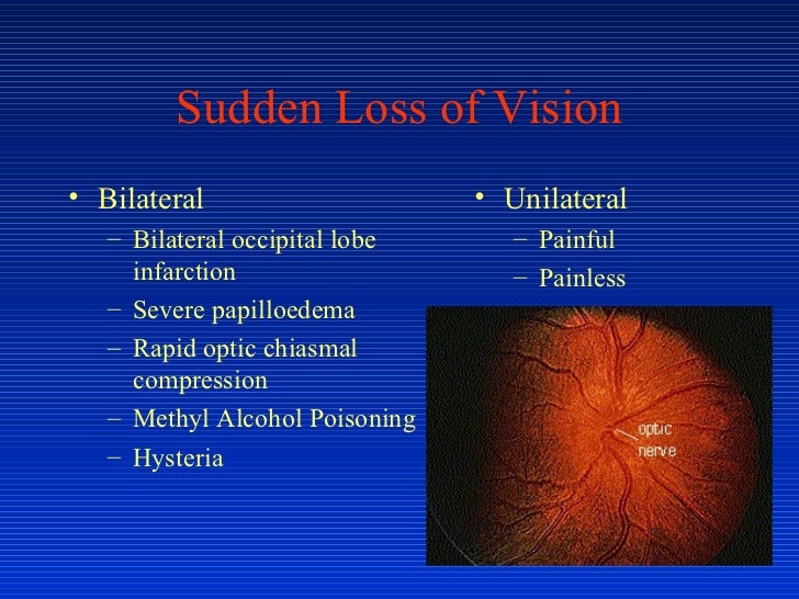 Amazing Sudden Change Of Vision In One Eye Background Art Amazing Sudden Change Of Vision In One Eye Background Art