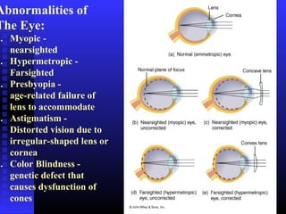Color Vision Abnormalities Eye | PPT