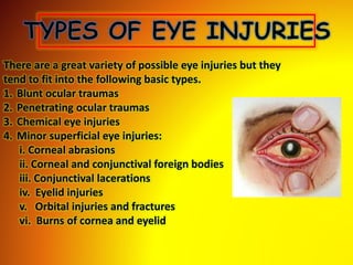 Eye | PPTX