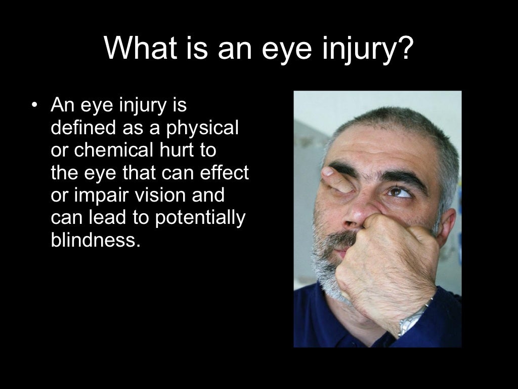 Eye Injuries