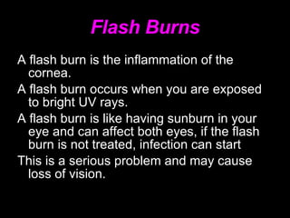 Flash Burns A flash burn is the inflammation of the cornea. A flash burn occurs when you are exposed to bright UV rays. A flash burn is like having sunburn in your eye and can affect both eyes, if the flash burn is not treated, infection can start This is a serious problem and may cause loss of vision. 