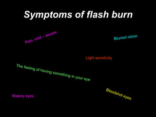 Symptoms of flash burn Pain, mild – severe   Bloodshot eyes Light sensitivity Watery eyes Blurred vision The feeling of having something in your eye 