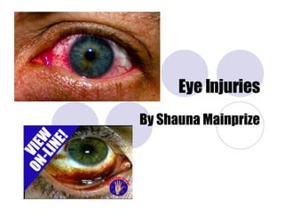 Eye Injuries By Shauna Mainprize 