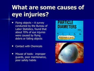 What are some causes of eye injuries? Flying objects – A survey conducted by the Bureau of Labor Statistics, found that about 70% of eye injuries were caused by flying debris or falling objects Contact with Chemicals Misuse of tools:  improper guards, poor maintenance, poor safety habits 