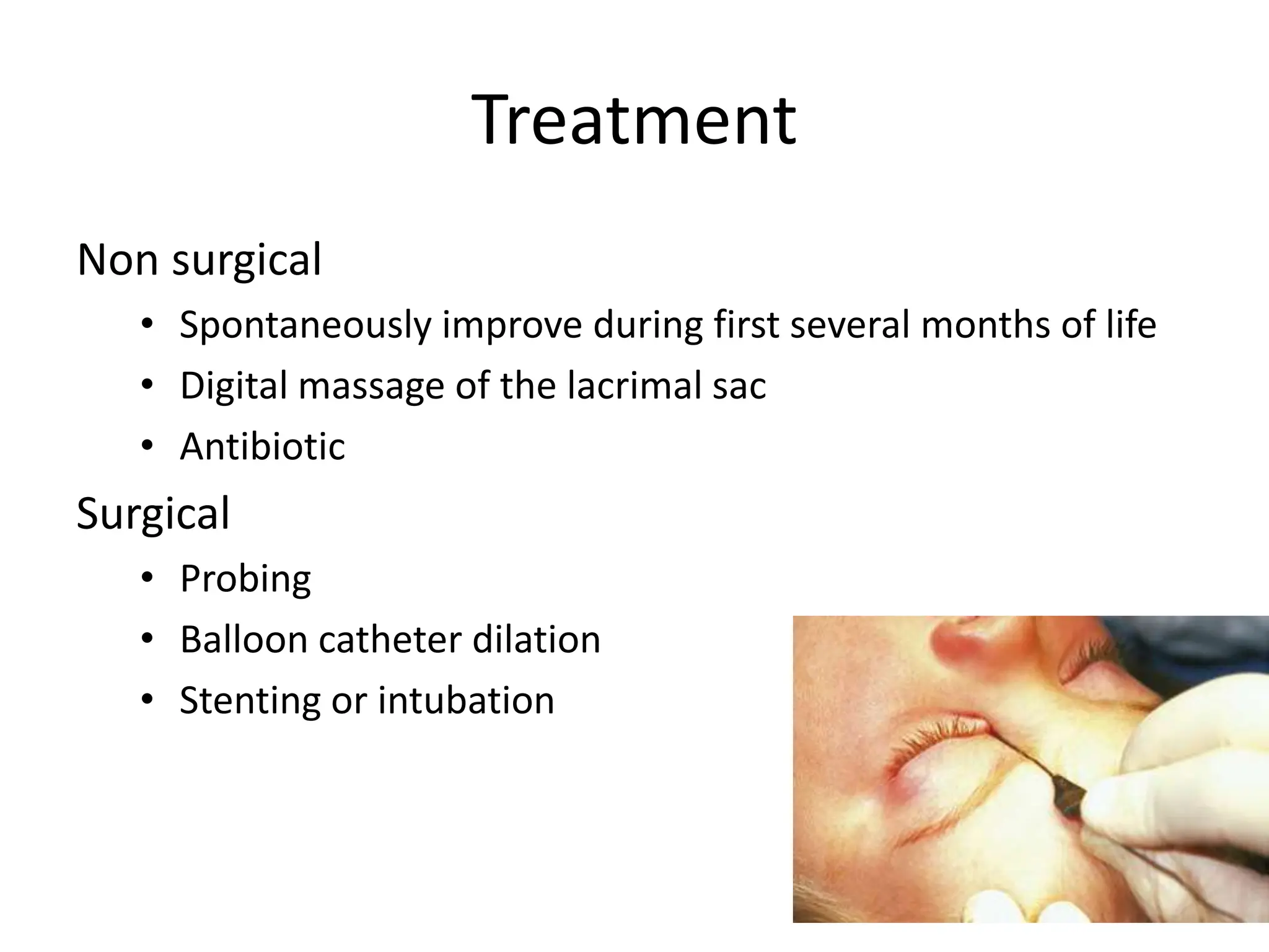 Nasolacrimal Duct Obstruction | PPTX