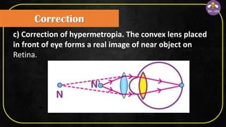 Correction
c) Correction of hypermetropia. The convex lens placed
in front of eye forms a real image of near object on
Retina.
 