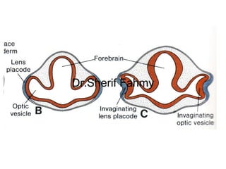 Development of Eye and Ear (Special Embryology) | PPS