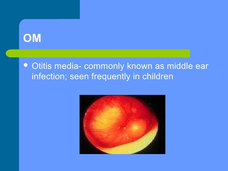 Eye and ear abbreviations
