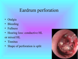 Ear Disintegration Eye and ear assessment | PPT