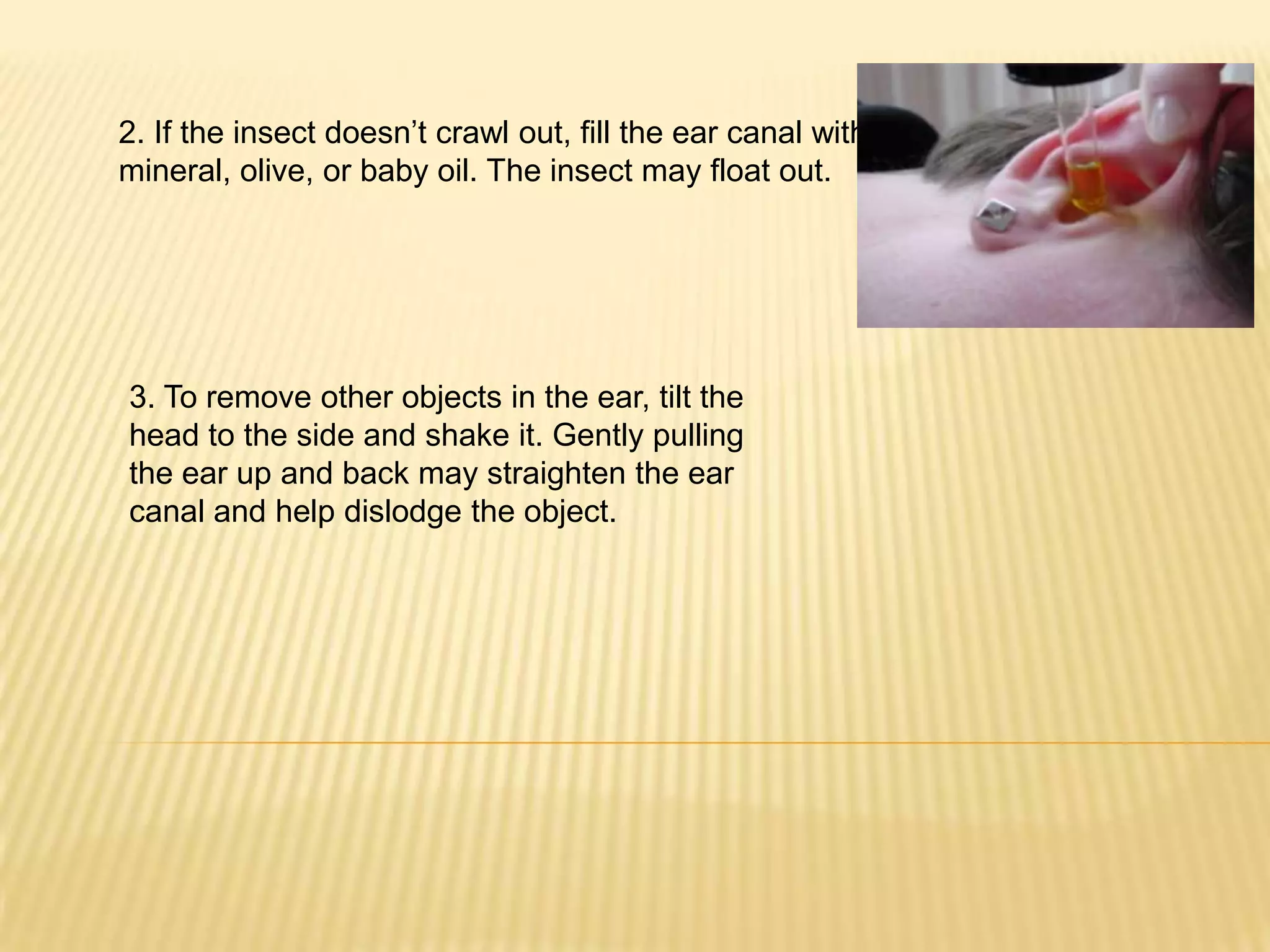 Eye and ear problems first aid | PPTX | Ear, Nose and Throat Conditions ...