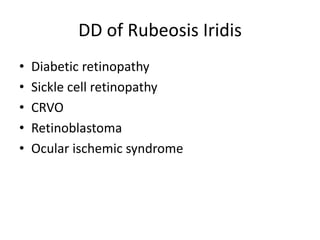 Eye as an indicator of systemic diseases | PPTX