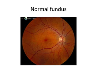 Eye an indicator of systemic diseases - General physical examination | PPTX