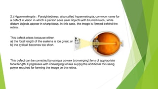 2.) Hypermetropia : Farsightedness, also called hypermetropia, common name for
a defect in vision in which a person sees near objects with blurred vision, while
distant objects appear in sharp focus. In this case, the image is formed behind the
retina.
This defect arises because either
a) the focal length of the eyelens is too great, or
b) the eyeball becomes too short.
This defect can be corrected by using a convex (converging) lens of appropriate
focal length. Eyeglasses with converging lenses supply the additional focussing
power required for forming the image on the retina.
 