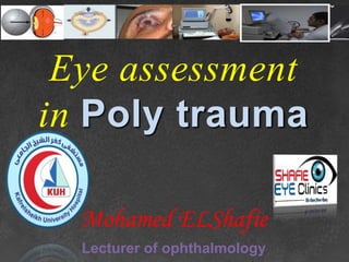 Eye assessment
in Poly trauma
Mohamed ELShafie
Lecturer of ophthalmology
 