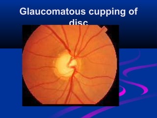 Eye atlas of disease (ayemon) | PDF