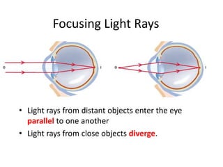 Left Close Rays eye disorder | PPTX