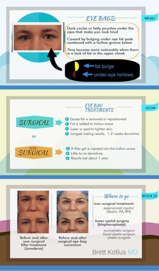 Eye bag treatments infographic
