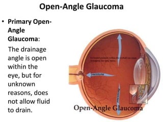 Eyeball Anatomy with histology | PPTX