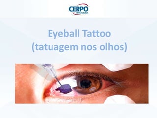 Eyeball Tattoo
(tatuagem nos olhos)
 