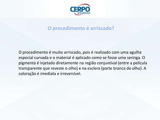 O procedimento é muito arriscado, pois é realizado com uma agulha
especial curvada e o material é aplicado como se fosse uma seringa. O
pigmento é injetado diretamente na região conjuntival (entre a película
transparente que reveste o olho) e na esclera (parte branca do olho). A
coloração é imediata e irreversível.
O procedimento é arriscado?
 