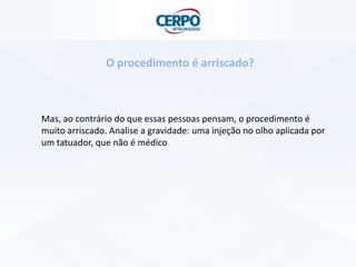Mas, ao contrário do que essas pessoas pensam, o procedimento é
muito arriscado. Analise a gravidade: uma injeção no olho aplicada por
um tatuador, que não é médico
O procedimento é arriscado?
 