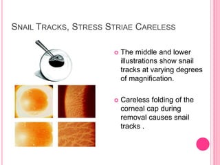Snail Track Rash Eye bank | PPTX